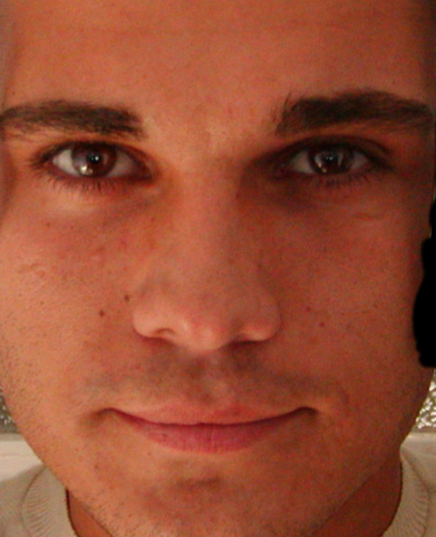 Bruno