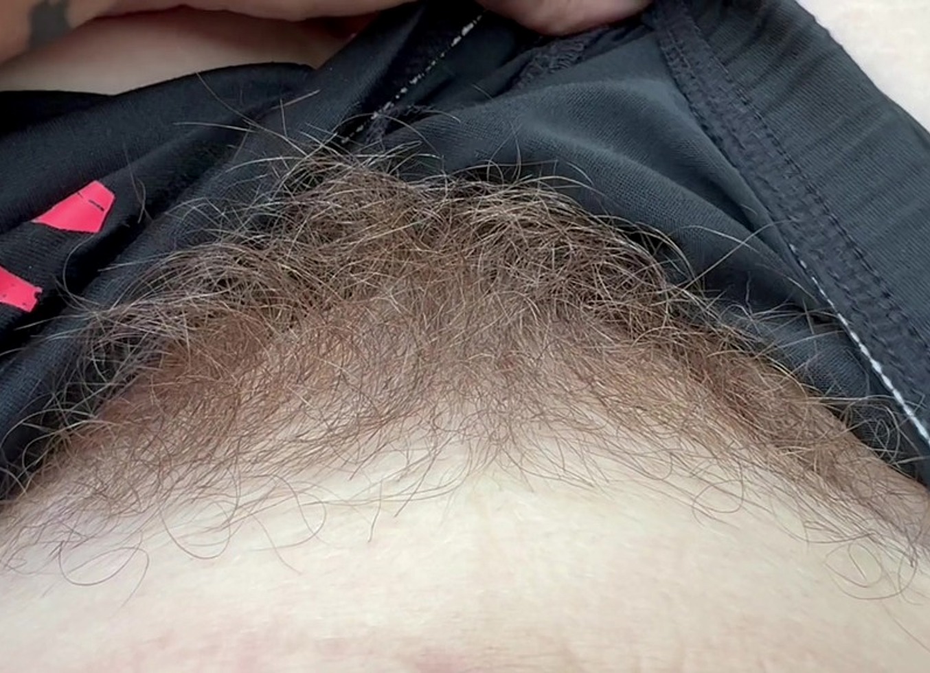 Hairy Bodyparts Current State Of My Hair