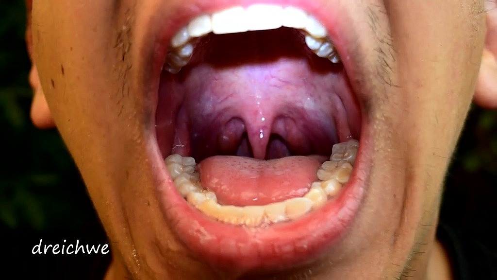 early morning uvula (Dreichwe) early morning uvula (Dreichwe)
