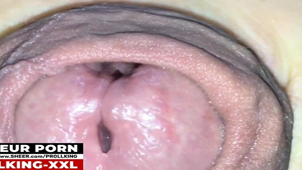 39 - playing with long foreskin (Prollkingxxl) 39 - playing with long foreskin (Prollkingxxl)