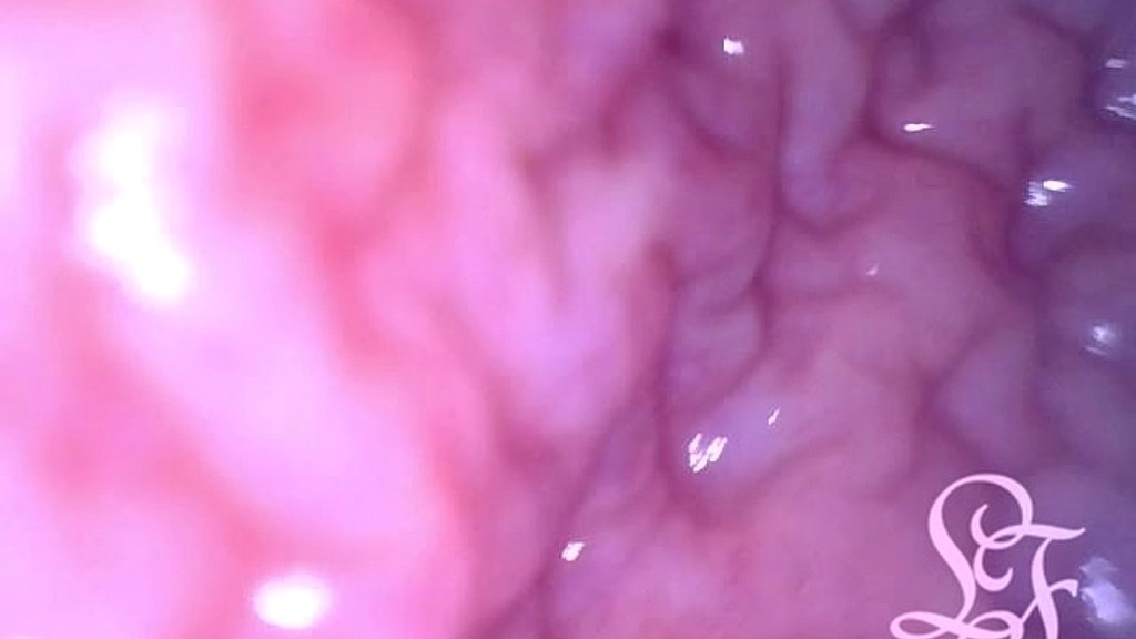 inside pov: inflating my bladder with air! (Lina Free) inside pov: inflating my bladder with air! (Lina Free)