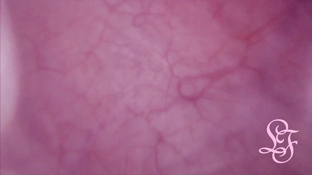 fucked in my pussy + camera in my bladder = crazy bulge! (Lina Free) fucked in my pussy + camera in my bladder = crazy bulge! (Lina Free)