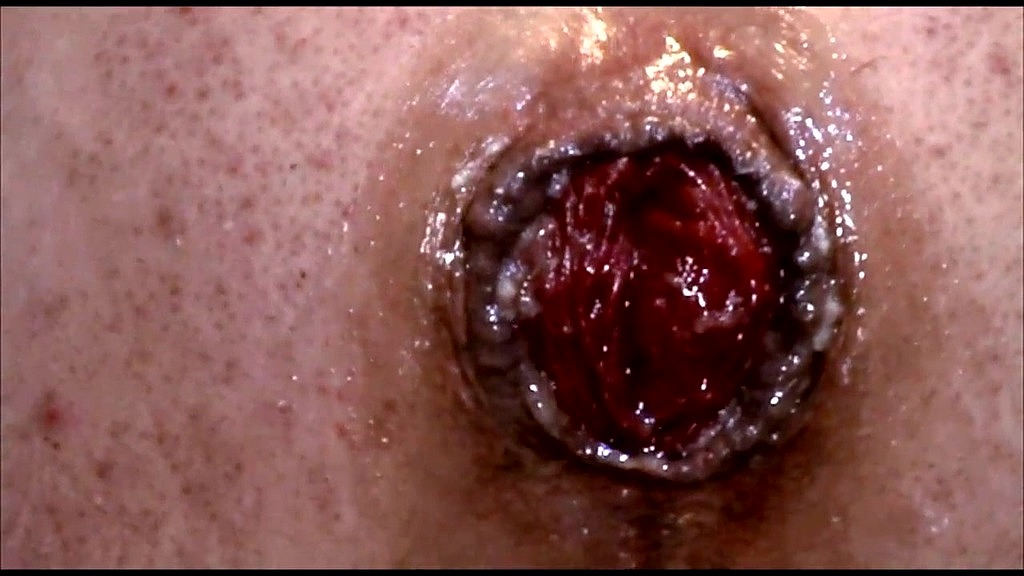 anal prolapse & pumping (Anitacox69) anal prolapse & pumping (Anitacox69)