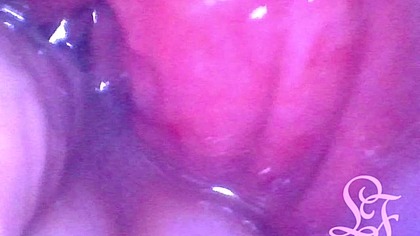 Endoscope inside POV of my juicy Ass getting fisted deeply