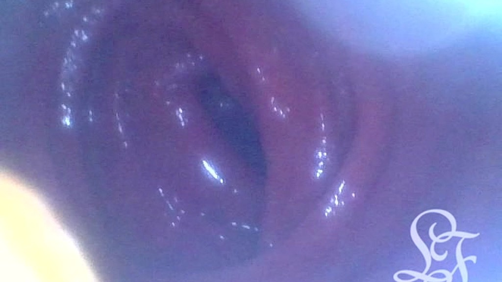 Lina Free: endoscopio anale fino al mio colon trasverso! (AnalVids.com) anal endoscope all the way in my transverse colon! (Lina Free)