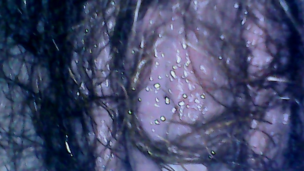 hairy exploration peeing with endoscope on the toilet (Nicoletta Embassi) hairy exploration peeing with endoscope on the toilet (Nicoletta Embassi)
