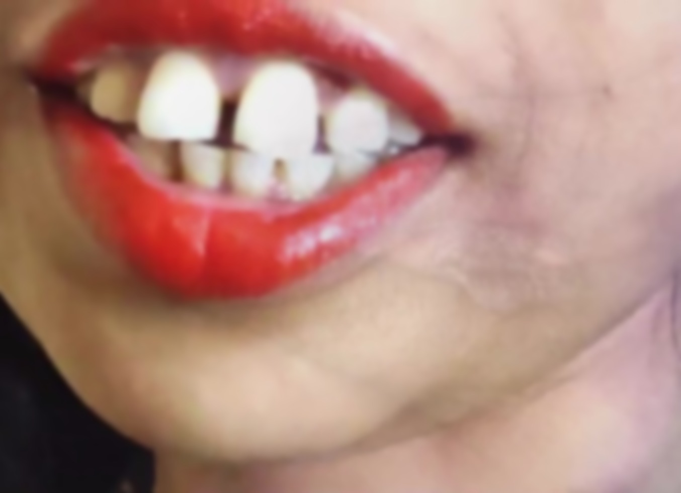 Desi Chut Khuli Thi Stepbrother Ne Khade Lund Ko Daal Diya Anal Sex