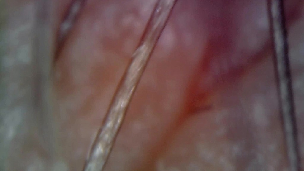 microscope or endoscope? sensational farts in a vore edition inside my ass 4k (Nicoletta Embassi) microscope or endoscope? sensational farts in a vore edition inside my ass 4k (Nicoletta Embassi)