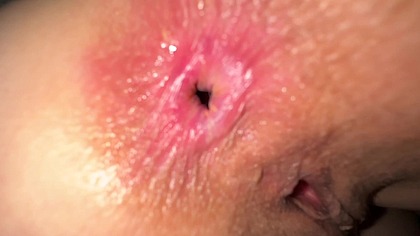 My stepdad says: Please fart because I can’t find your butthole in darkness