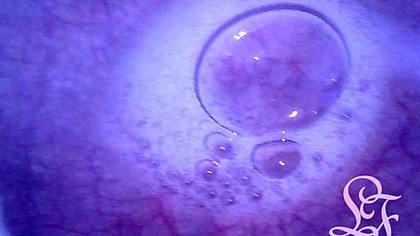 Pumping Air into my full Bladder with the Minicam inside