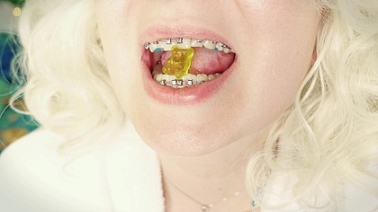 ASMR mukbang: eating in braces!