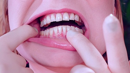 I wanna play with you in dentist games... ASMR video