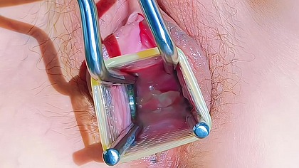 vaginaldischarge/gapingpussy/Chinese masturbation