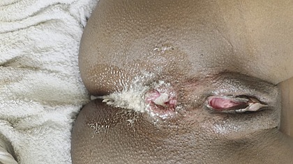 Anal creampie