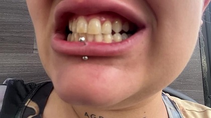 teeth check-up on the bus