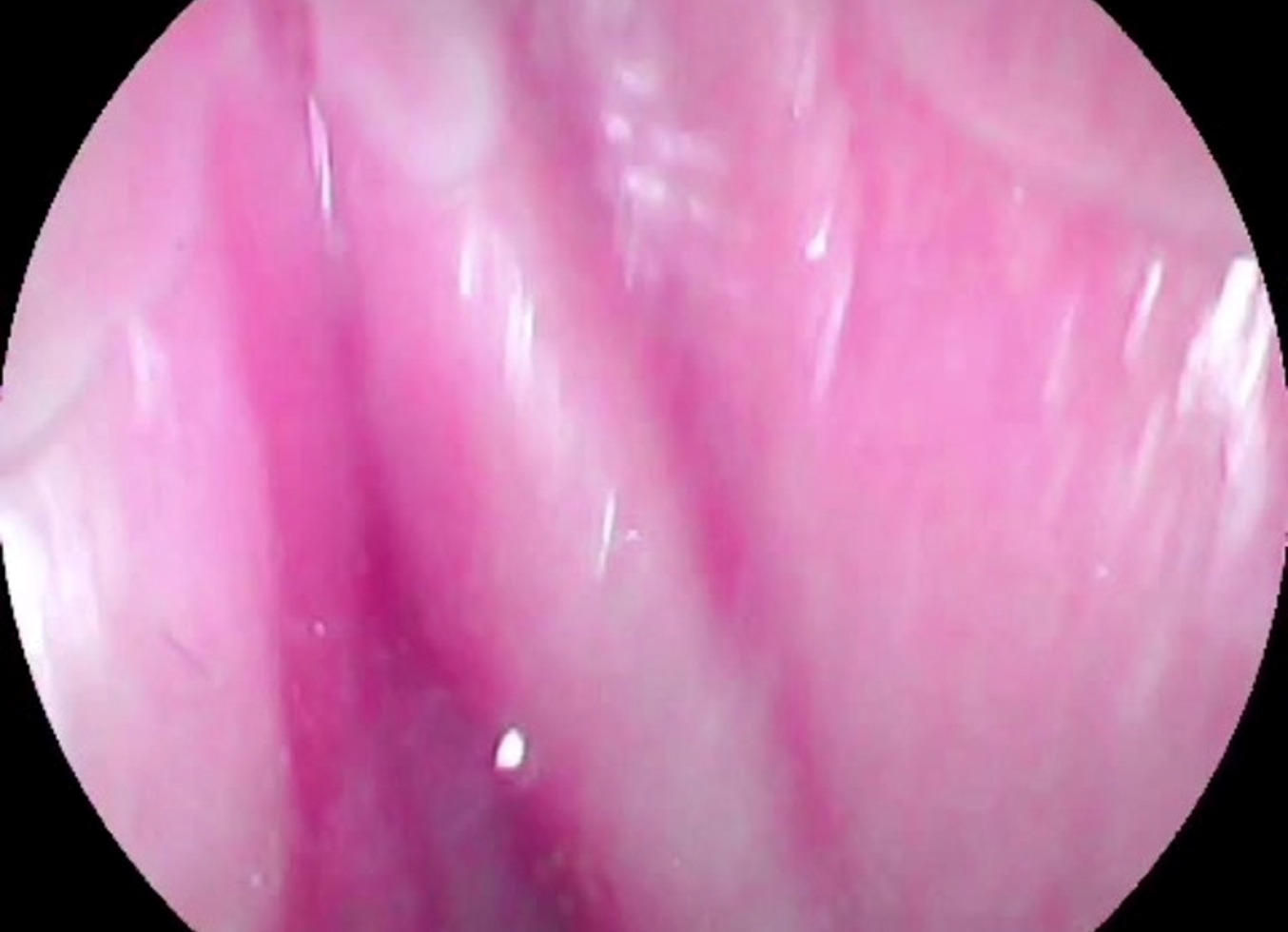 Camera Inside My Creamy Juicy Pussy