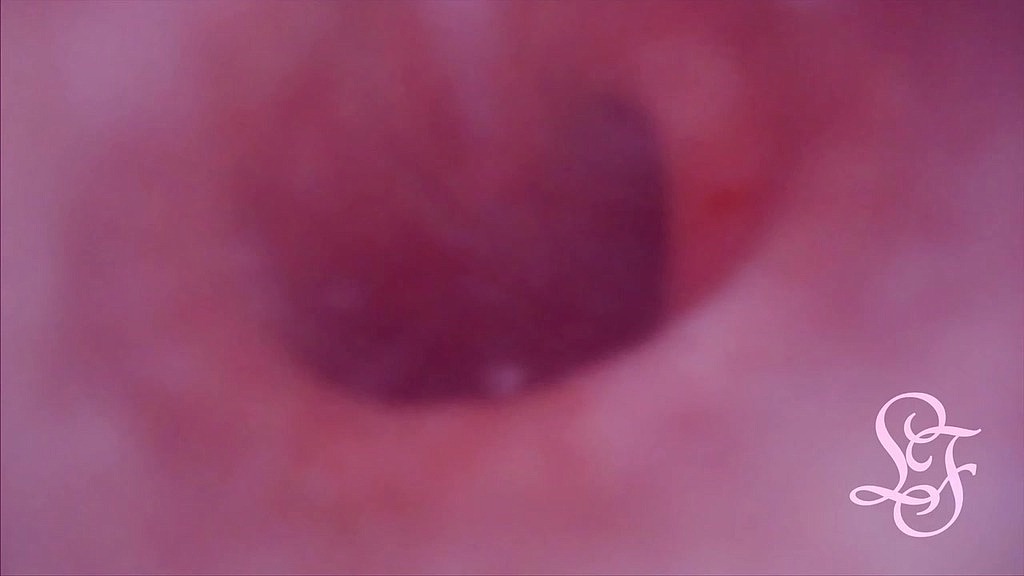 fucked in my pussy + camera in my bladder = crazy bulge! (Lina Free) fucked in my pussy + camera in my bladder = crazy bulge! (Lina Free)