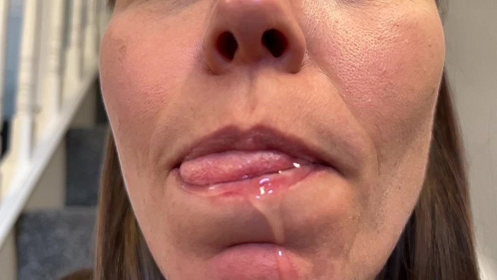 tongue saliva (Wamgirx) tongue saliva (Wamgirx)