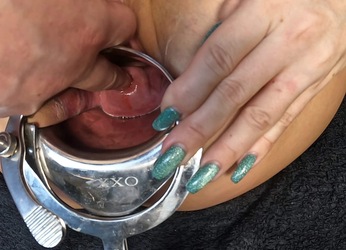 Cervix Fingering