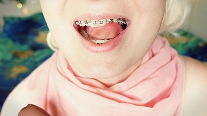 ASMR mukbang: eating in braces