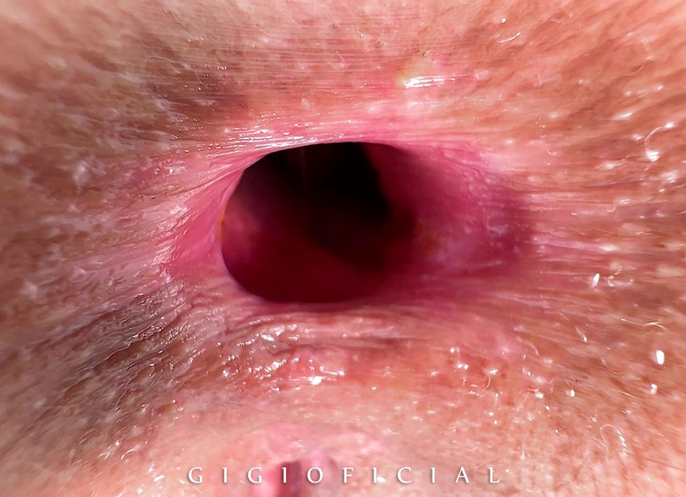 My Reputation Is Fucked! Stepdaughter Became The Anal Opening Queen!