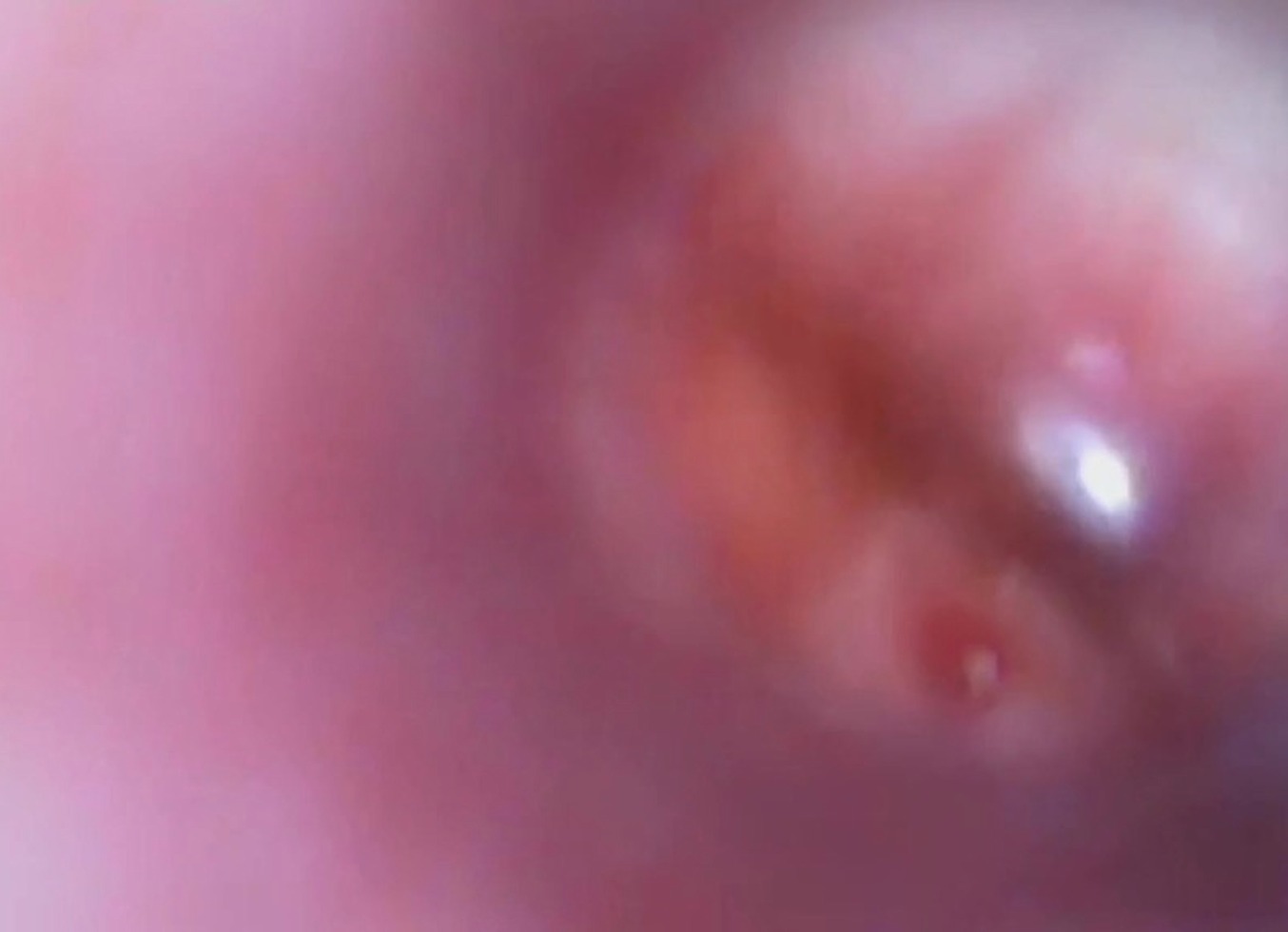 Quianon - Cervix Extreme Exploration