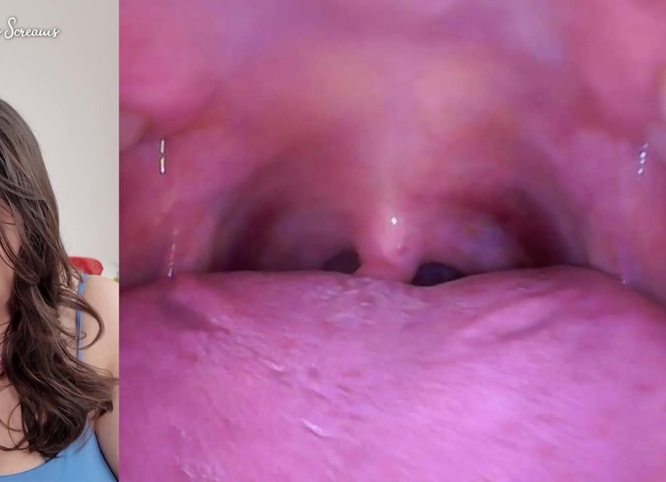 Deep Inside Sydney's Mouth