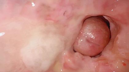 18 yesrs old girl gave me a mock-up of her anus from the inside and I came right there!