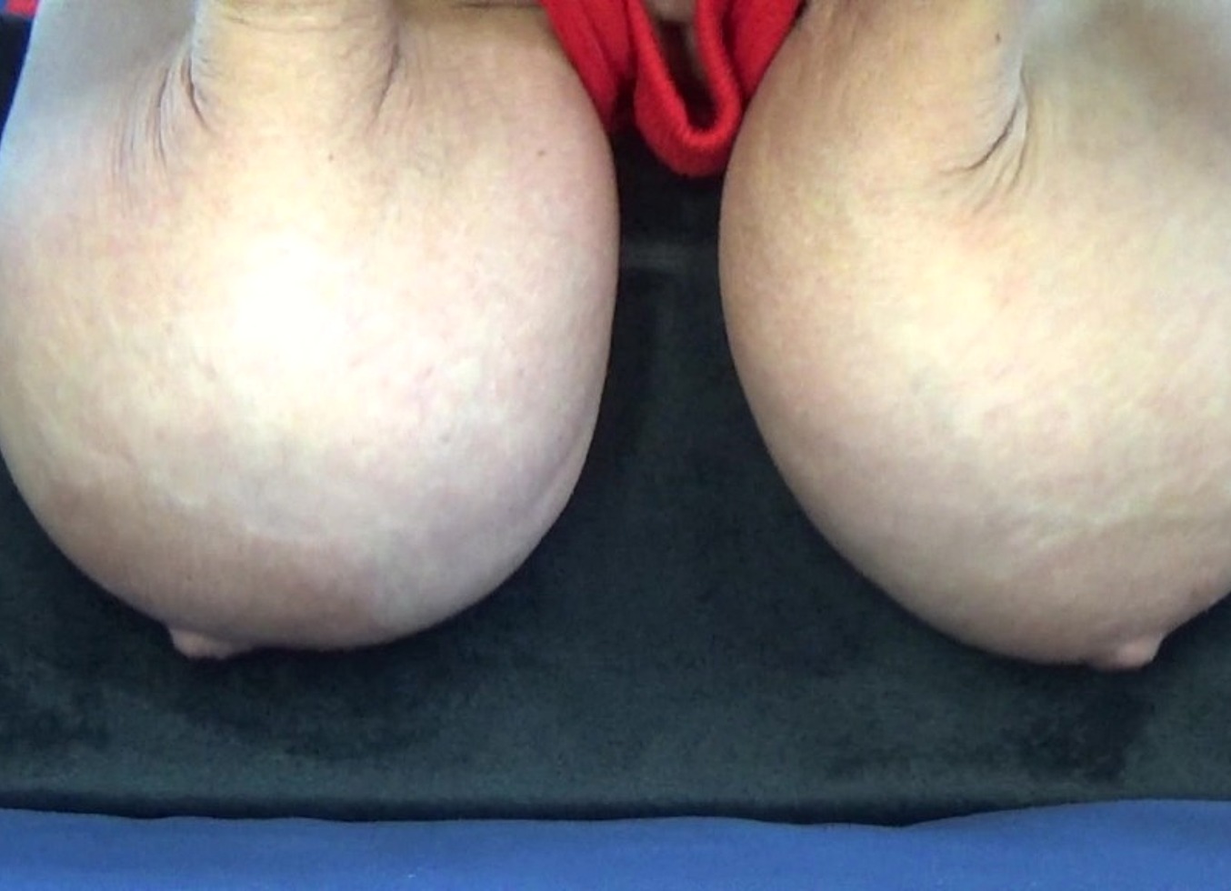 Adult Saggy Boobs Close Up