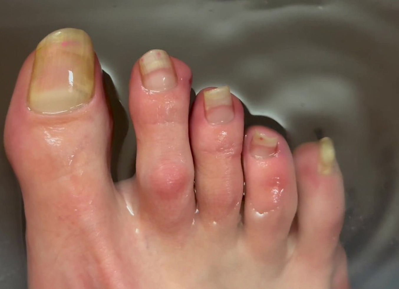 All Natural Long Toe Nail Fetish Video Closeup Toes Foot Feet