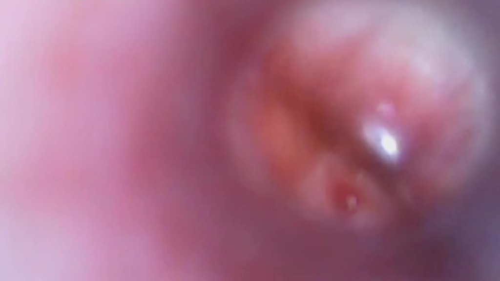 Quianon - Cervix extreme exploration