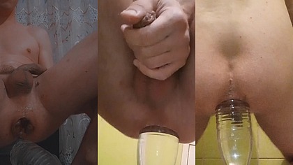 Fisting with a huge bottle until a prolapse comes out