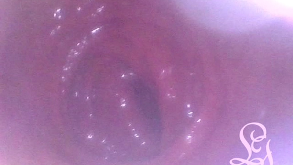 anal endoscope all the way in my transverse colon! (Lina Free) anal endoscope all the way in my transverse colon! (Lina Free)