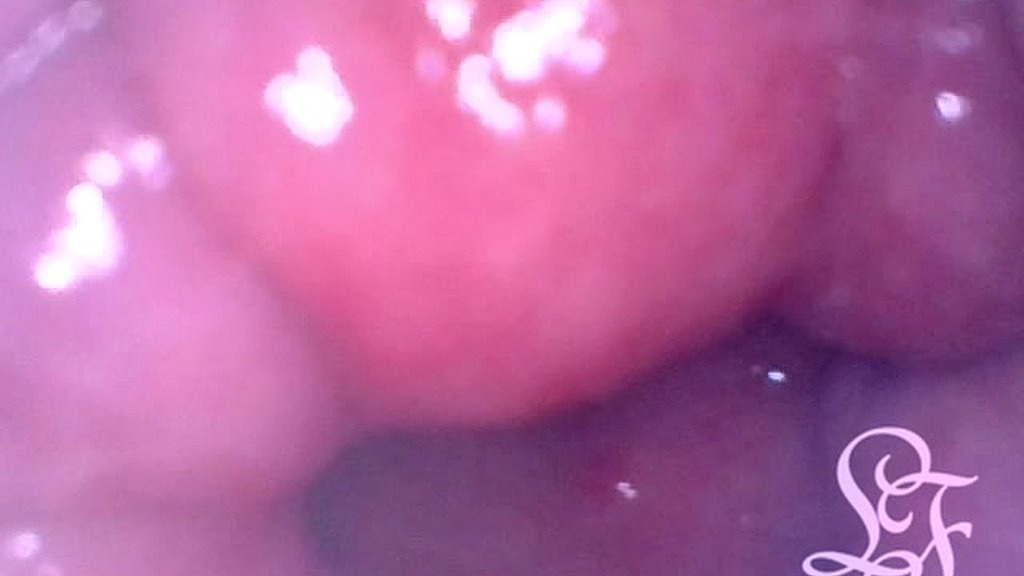 Lina Free: pov fisting filmed from deep inside my ass! (AnalVids.com) pov fisting filmed from deep inside my ass! (Lina Free)